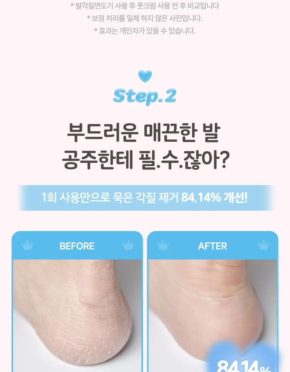 [매끈발템/올인원풋케어] 플루 퍼펙트 발 각질 케어 세트 (발각질 제거기+크림) 상세페이지 6